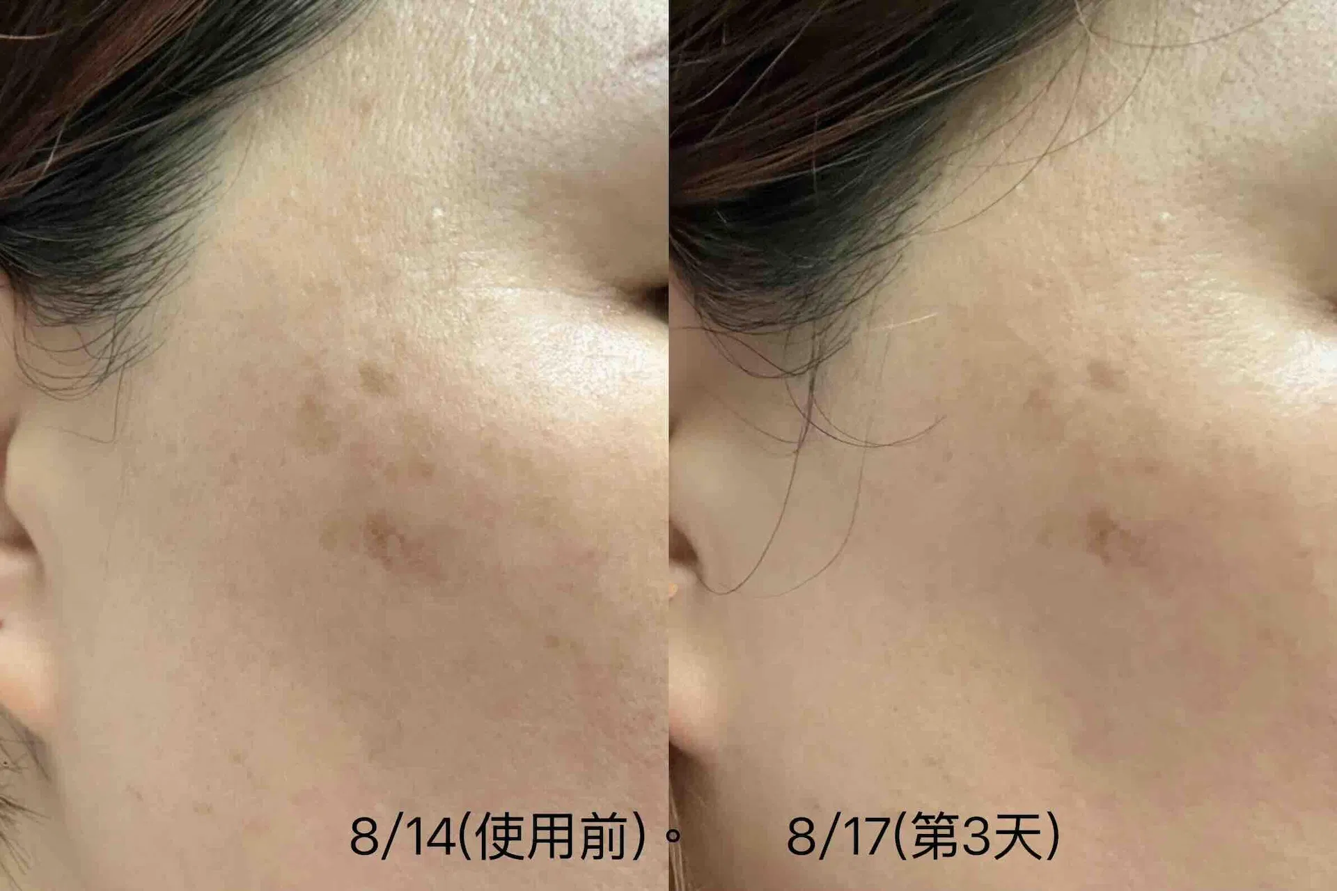 太極之初使用者分享：使用前後紀錄