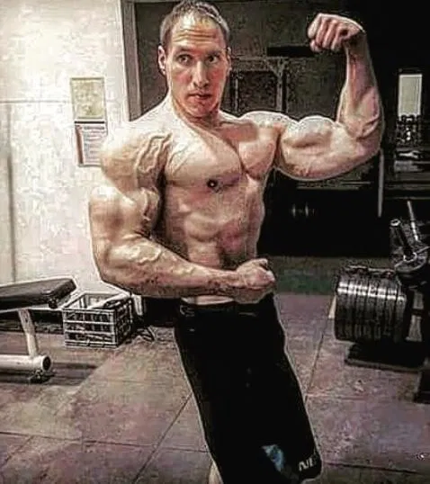 Muscle Matters: The Overlooked Predictor of Mortality