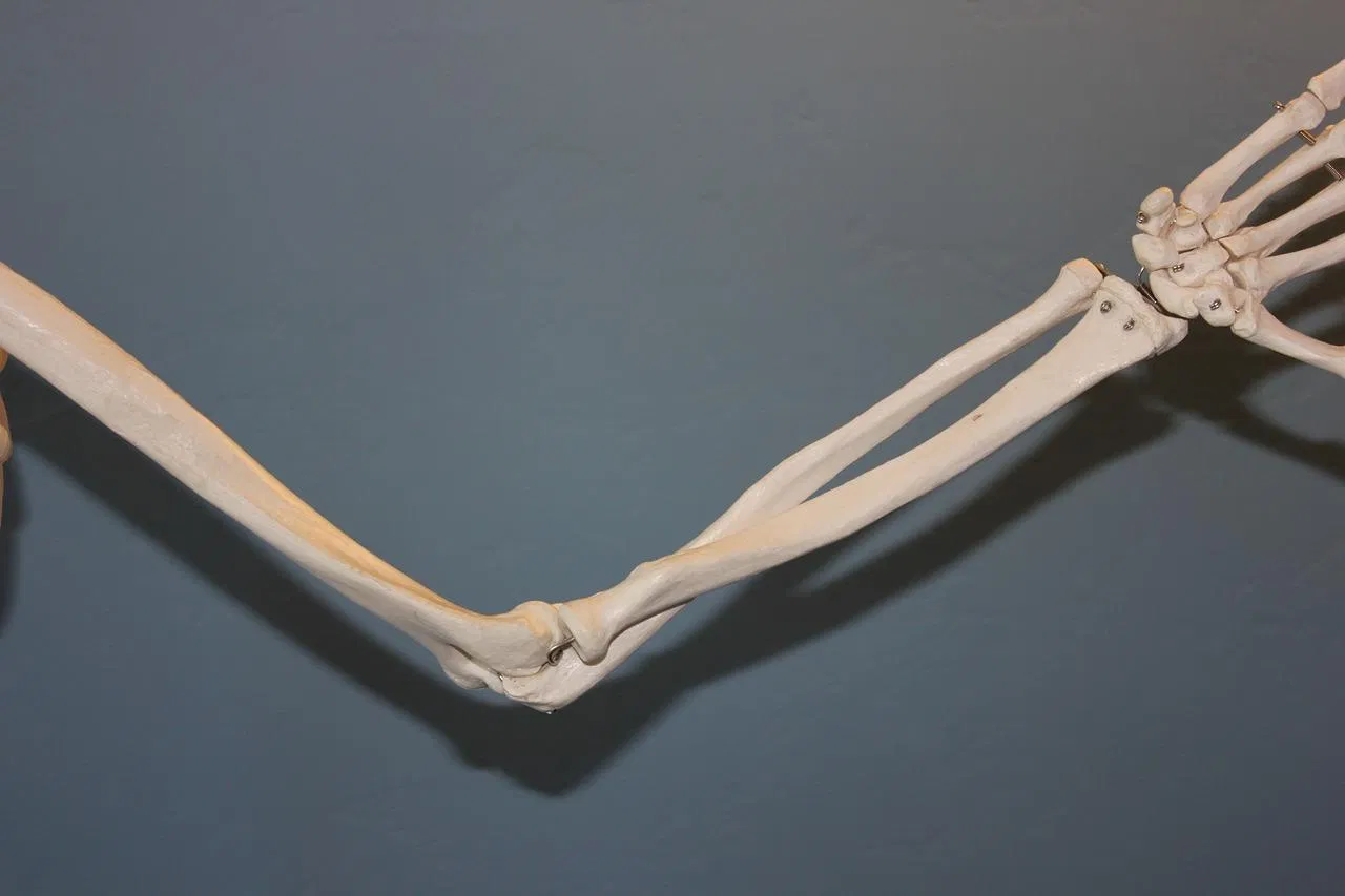 Healing Elbow Tendonitis: Top Treatments and Recovery Tips for Pain Relief