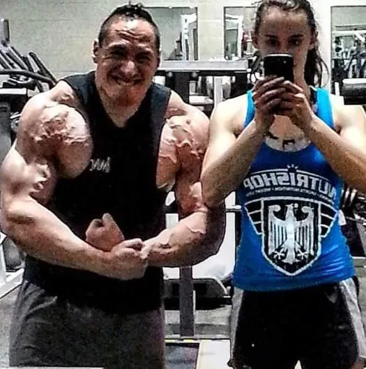 Muscle Growth Without Boundaries: Revisiting Gender Differences in Hypertrophy