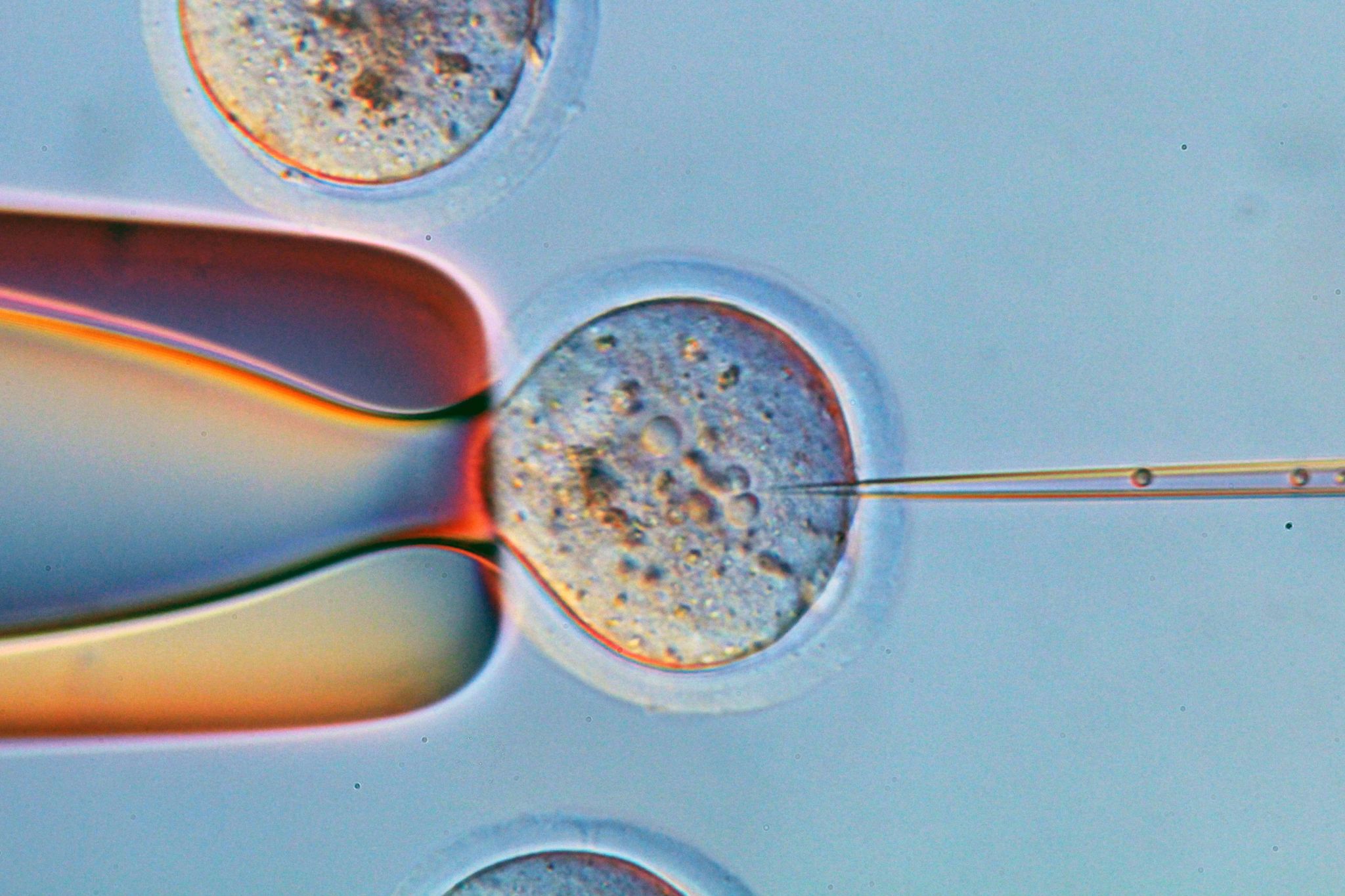 細菌的死亡筆記本—CRISPR/Cas 基因編輯技術