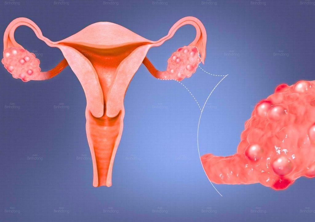 Rong kinh tiền mãn kinh: Nguyên nhân, triệu chứng và giải pháp chăm sóc sức khỏe toàn diện