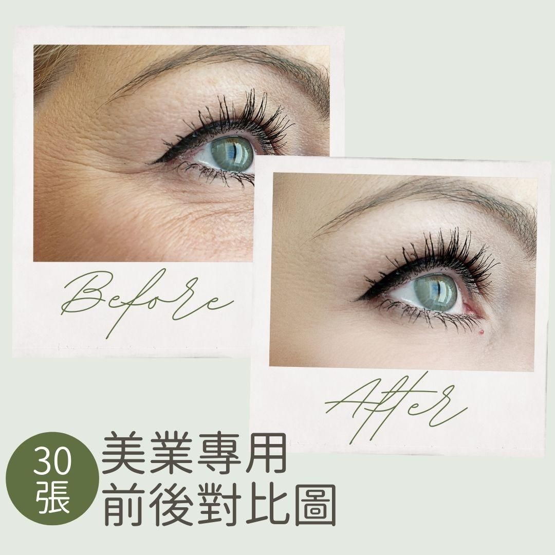 迷霧綠-30張-前後比對圖-圖文模版-FB、IG-社群