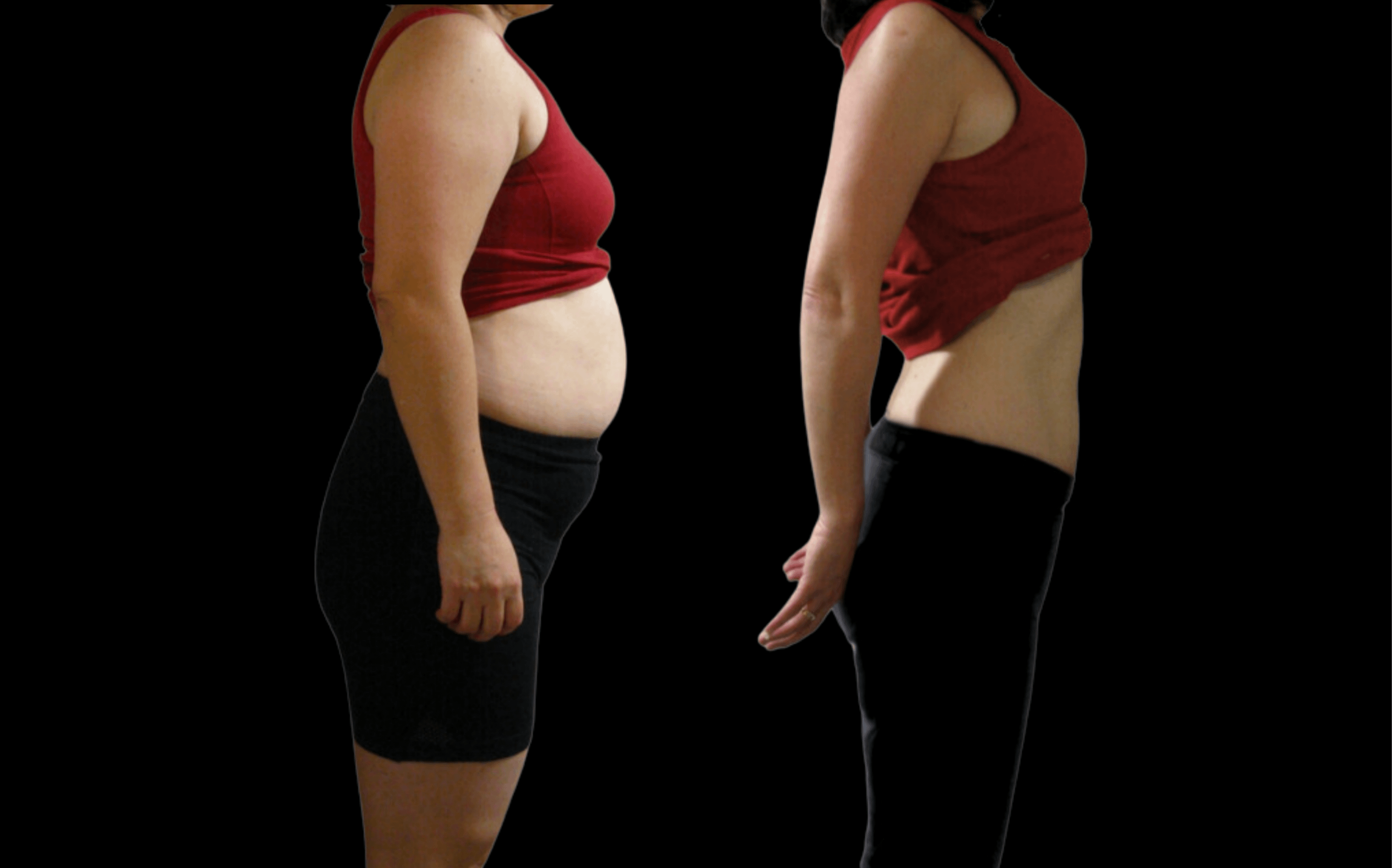 KimiBarre學員ＢＡ｜美型運動案例