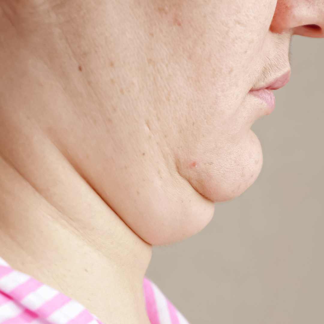 雙下巴的成因：生活習慣與姿勢的重要性