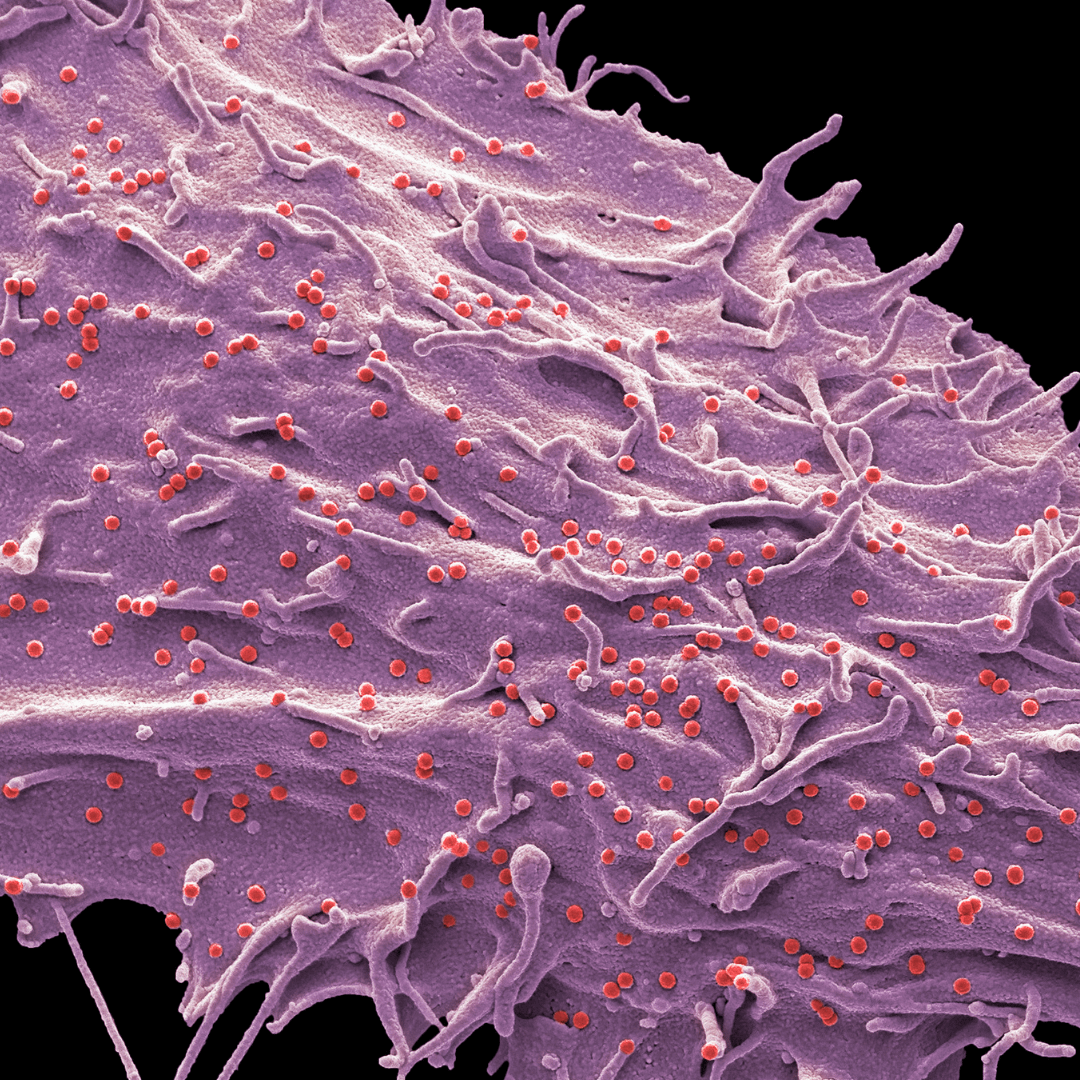 冷凍外泌體與乾粉外泌體：保存技術的全面比較