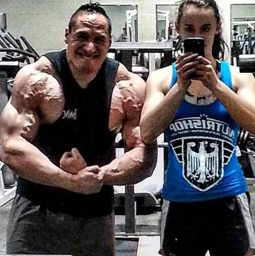 Muscle Growth Without Boundaries: Revisiting Gender Differences in Hypertrophy